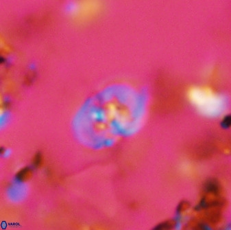 Bifidalithus geminicatillus 33662