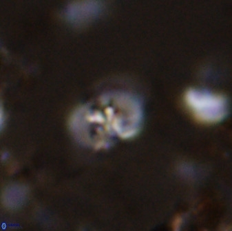 Bifidalithus geminicatillus 33663