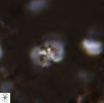 Bifidalithus geminicatillus 33663