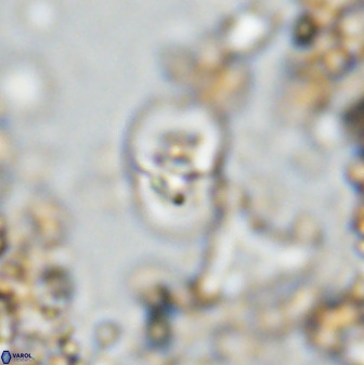 Bifidalithus geminicatillus 33664