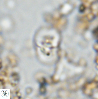 Bifidalithus geminicatillus 33664