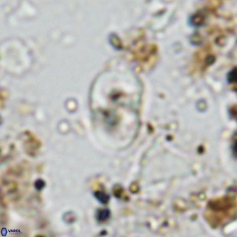 Bifidalithus geminicatillus 33665