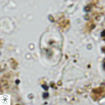 Bifidalithus geminicatillus 33665