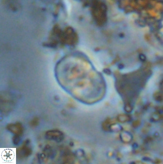 Bifidalithus geminicatillus 33666