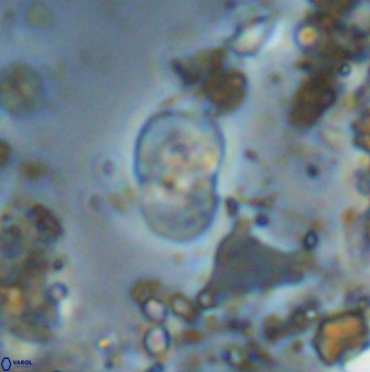 Bifidalithus geminicatillus 33667