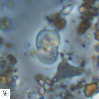 Bifidalithus geminicatillus 33667