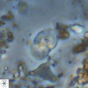 Bifidalithus geminicatillus 33668
