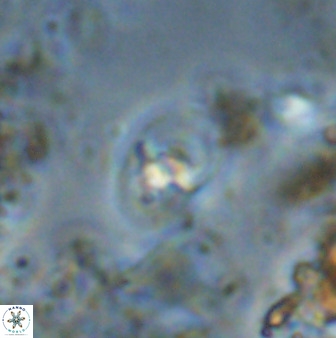 Bifidalithus geminicatillus 33669