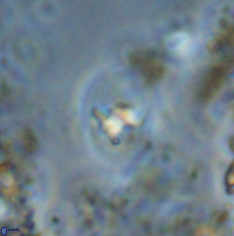 Bifidalithus geminicatillus 33670