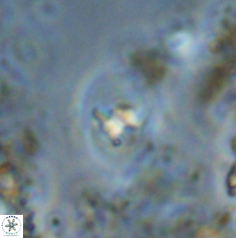 Bifidalithus geminicatillus 33670