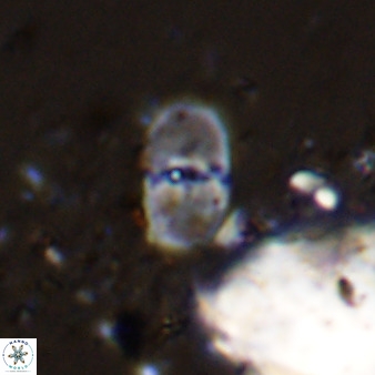 Bifidalithus geminicatillus 33802