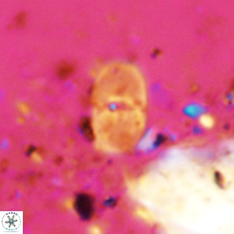 Bifidalithus geminicatillus 33803