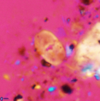 Bifidalithus geminicatillus 33804