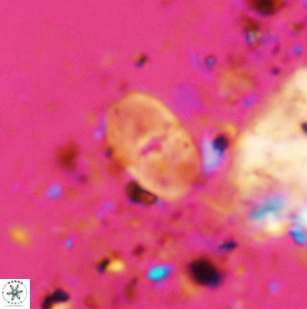 Bifidalithus geminicatillus 33804