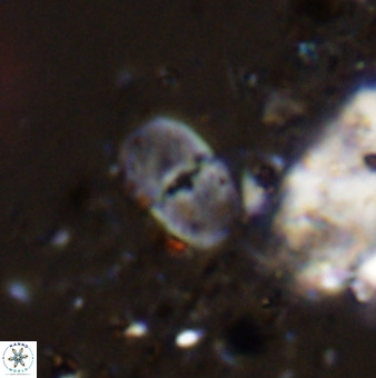 Bifidalithus geminicatillus 33805