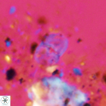 Bifidalithus geminicatillus 33806