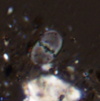 Bifidalithus geminicatillus 33807