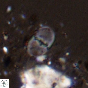 Bifidalithus geminicatillus 33807