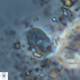 Bifidalithus geminicatillus 33808