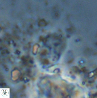 Bifidalithus geminicatillus 33809