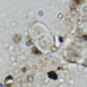 Bifidalithus geminicatillus 33811