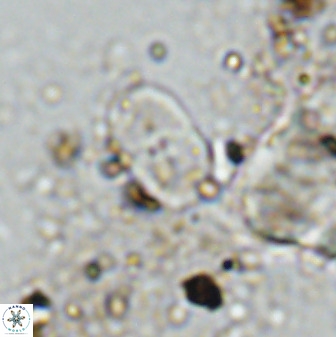 Bifidalithus geminicatillus 33811