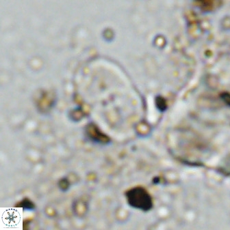 Bifidalithus geminicatillus 33812