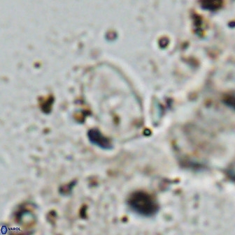 Bifidalithus geminicatillus 33813