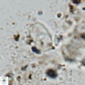 Bifidalithus geminicatillus 33813