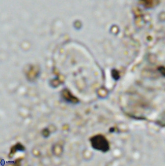 Bifidalithus geminicatillus 33814