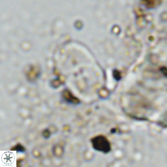 Bifidalithus geminicatillus 33814