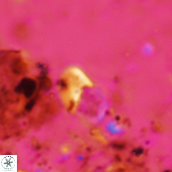 Bifidalithus geminicatillus 545