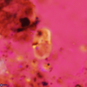 Bifidalithus geminicatillus 546