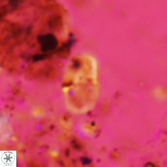 Bifidalithus geminicatillus 546
