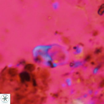 Bifidalithus geminicatillus 547