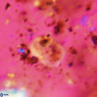 Bifidalithus geminicatillus 541