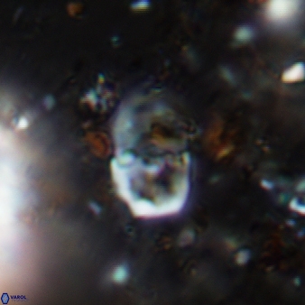 Bifidalithus geminicatillus 543