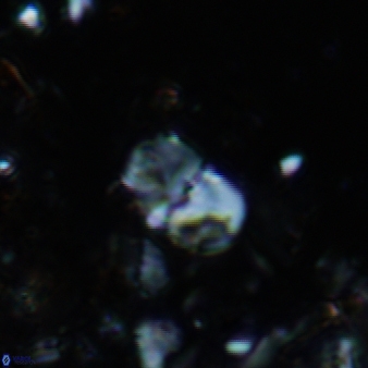 Bifidalithus geminicatillus 586