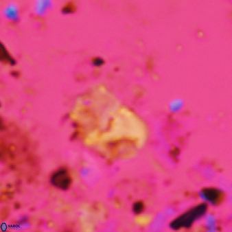 Bifidalithus geminicatillus 587