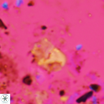Bifidalithus geminicatillus 587