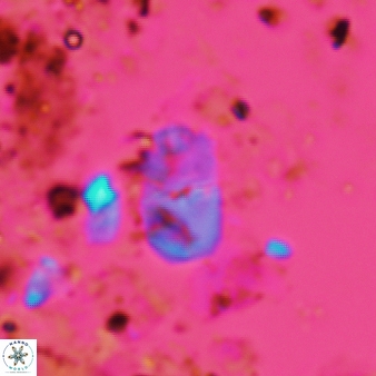 Bifidalithus geminicatillus 588