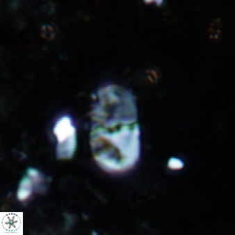 Bifidalithus geminicatillus 589