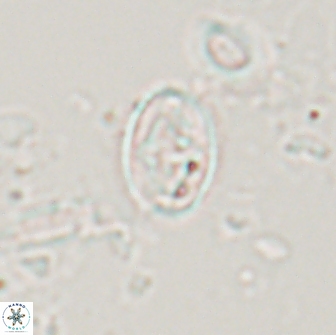Bilenia fatmae 17522