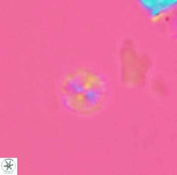 Biscutum ignotus 2705