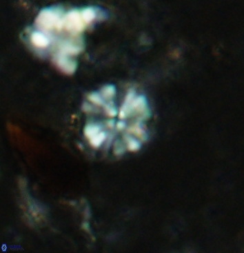 Biscutum testudinarium 5962