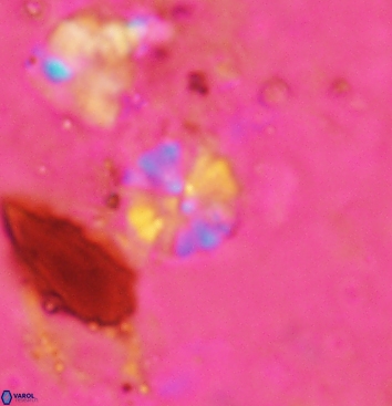 Biscutum testudinarium 5963