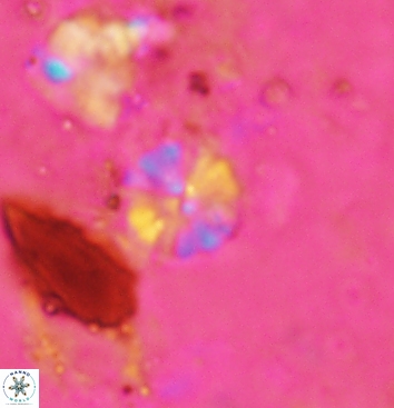 Biscutum testudinarium 5963