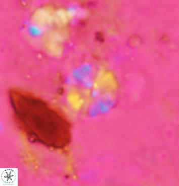 Biscutum testudinarium 5964