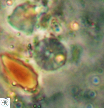 Biscutum testudinarium 5965