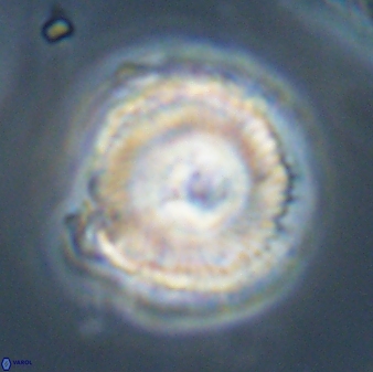Bomolithus cantabriae 58495
